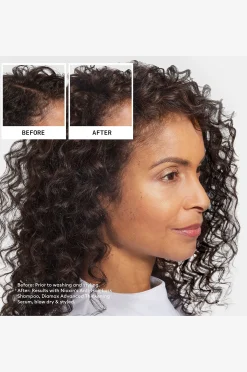 Anti-Hairloss Shampoo