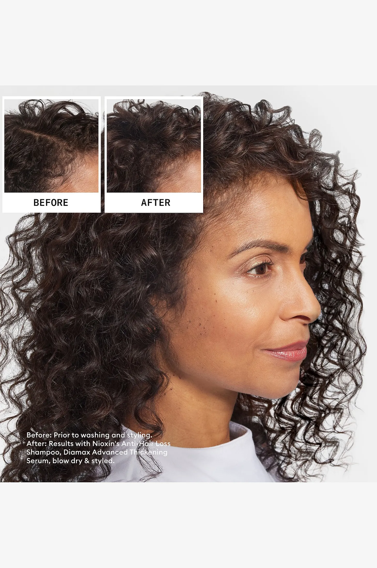 Anti-Hairloss Shampoo