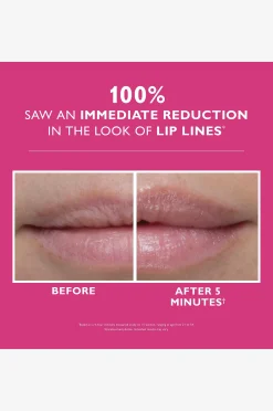 Instant Firmx® Lip Filler 10 ml