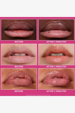 Instant Firmx® Lip Filler 10 ml
