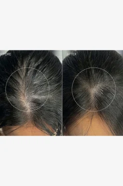 LUNA™ Dual-Peptide Scalp Serum 60Ml