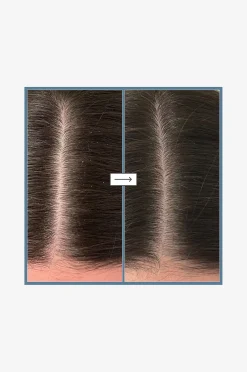 Scalp Revival™ Rosemary Pre-Wash Oil 100 ml