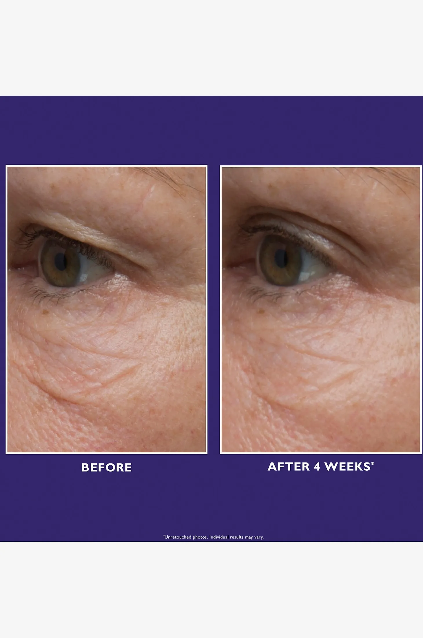 Ultimate Solution 5™ Eye Cream